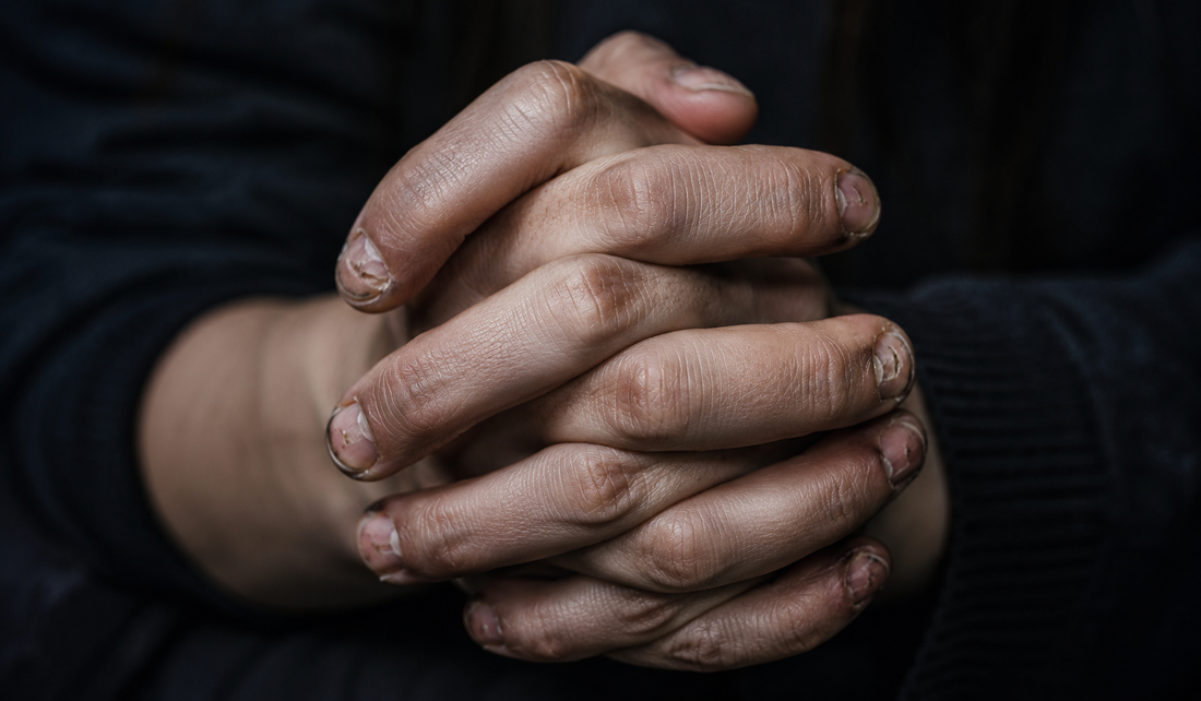Does Anxiety Cause Nail Picking?