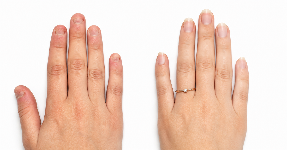Nail Biting vs. Nail Picking: What's the Difference and Does It Matter?